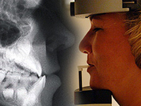 Cephalometric xray Cephalometric X-Ray