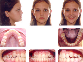 Orthodontic Photographs